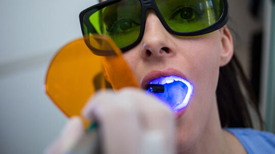 Clareamento Dental: Recupere o Brilho do Seu Sorriso com Segurança